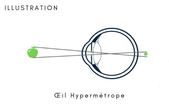 Clinic ophthalmologic - Eye Microsurgery - Kishinev center